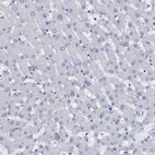 Immunohistochemical staining of human liver shows no positivity in hepatocytes as expected.