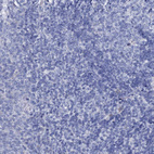 Immunohistochemical staining of human tonsil shows no positivity in non-germinal center cells as expected.