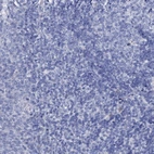 Immunohistochemical staining of human tonsil shows no positivity in non-germinal center cells as expected.