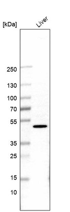 Western blot analysis in human liver tissue.