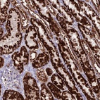 Anti-HOGA1 Antibody