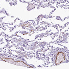 Immunohistochemical staining of human lung shows strong cytoplasmic positivity in endothelial cells.