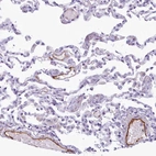 Immunohistochemical staining of human lung shows strong cytoplasmic positivity in endothelial cells.