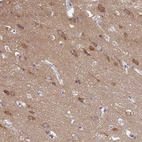 Immunohistochemical staining of human cerebral cortex shows high expression.