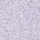 Immunohistochemical staining of human liver shows no positivity in hepatocytes as expected.
