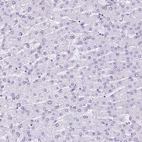 Immunohistochemical staining of human liver shows no positivity in hepatocytes as expected.