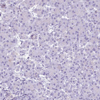 Immunohistochemical staining of human pancreas shows no positivity in exocrine glandular cells as expected.