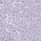 Immunohistochemical staining of human pancreas shows no positivity in exocrine glandular cells as expected.