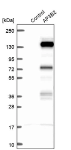 Western blot analysis in control (vector only transfected HEK293T lysate) and AP3B2 over-expression lysate (Co-expressed with a C-terminal myc-DDK tag (~3.1 kDa) in mammalian HEK293T cells, LY401473).