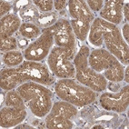 Immunohistochemical staining of human kidney shows weak cytoplasmic positivity in cells in tubules.