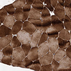 Immunohistochemical staining of human skeletal muscle shows strong cytoplasmic positivity in myocytes.