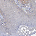 Immunohistochemical staining of human skin shows no positivity in squamous epithelial cells as expected.