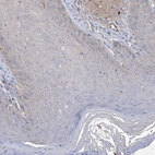 Immunohistochemical staining of human skin shows no positivity in squamous epithelial cells as expected.