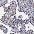 Immunohistochemical staining of human placenta shows moderate to strong membranous positivity in endothelial cells.