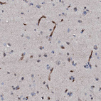 Immunohistochemical staining of human cerebral cortex shows strong membranous positivity in endothelial cells.