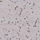 Immunohistochemical staining of human cerebral cortex shows strong membranous positivity in endothelial cells.