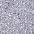 Immunohistochemical staining of human liver shows low positivity in hepatocytes as expected.