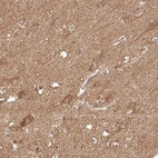 Immunohistochemical staining of human cerebral cortex shows moderate positivity in neuropil.