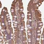 Immunohistochemical staining of human small intestine shows moderate cytoplasmic positivity in glandular cells.
