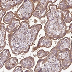 Immunohistochemical staining of human placenta shows moderate granular cytoplasmic positivity in trophoblastic cells.