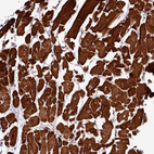 Immunohistochemical staining of human heart muscle shows strong cytoplasmic positivity in cardiomyocytes.