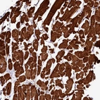 Immunohistochemical staining of human heart muscle shows strong cytoplasmic positivity in cardiomyocytes.