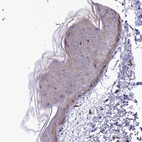 Immunohistochemical staining of human skin shows very weak positivity in squamous epithelial cells as expected.