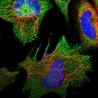 Immunofluorescent staining of human cell line U-2 OS shows localization to plasma membrane & cytosol.