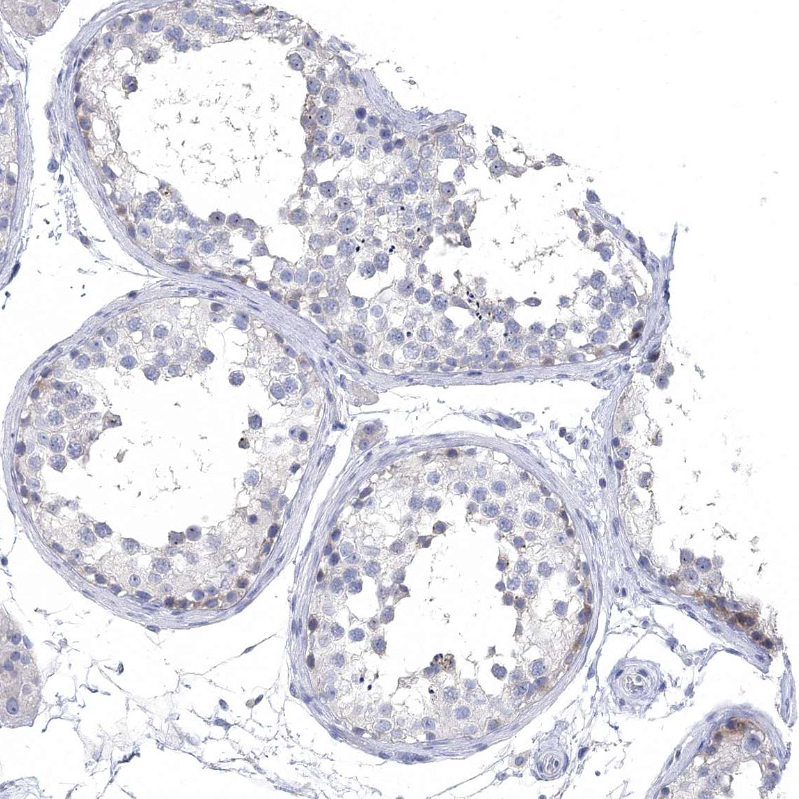 Anti-NLRP14 Antibody