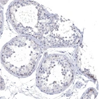 Anti-NLRP14 Antibody