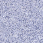 Immunohistochemical staining of human pancreas shows no positivity in exocrine glandular cells as expected.