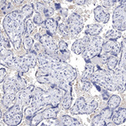 Immunohistochemical staining of human placenta shows no positivity in trophoblastic cells as expected.