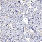Immunohistochemical staining of human placenta shows no positivity in trophoblastic cells as expected.