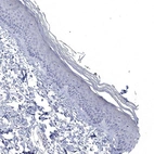 Immunohistochemical staining of human skin shows no positivity in squamous epithelial cells as expected.