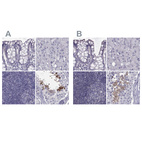 Immunohistochemical staining of human colon, liver, lymph node and testis using Anti-FAM71B antibody HPA039478 (A) shows similar protein distribution across tissues to independent antibody HPA040771 (B).
