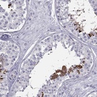 Immunohistochemical staining of human testis shows high expression.