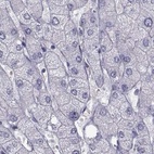 Immunohistochemical staining of human liver using Anti-FAM71B antibody HPA039478.