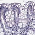 Immunohistochemical staining of human colon using Anti-FAM71B antibody HPA039478.