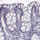 Immunohistochemical staining of human colon using Anti-FAM71B antibody HPA039478.