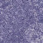 Immunohistochemical staining of human lymph node using Anti-FAM71B antibody HPA039478.