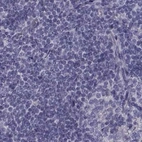 Immunohistochemical staining of human lymph node using Anti-FAM71B antibody HPA039478.