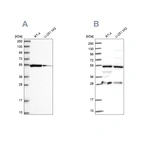 Western blot analysis using Anti-PACSIN3 antibody HPA039480 (A) shows similar pattern to independent antibody HPA043904 (B).