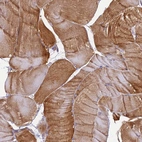 Anti-EHBP1L1 Antibody