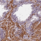Immunohistochemical staining of human prostate shows strong cytoplasmic positivity in smooth muscle cells.