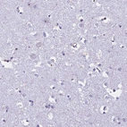 Immunohistochemical staining of human cerebral cortex shows no positivity in neurons as expected.