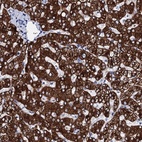 Anti-GYS2 Antibody