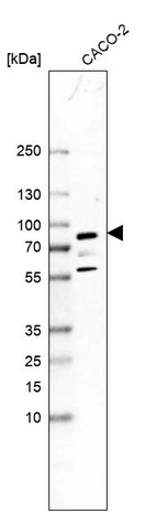 Western blot analysis in human cell line CACO-2.