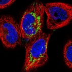 Immunofluorescent staining of human cell line A-431 shows localization to mitochondria.