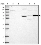 Lane 1: Marker [kDa] 250, 130, 95, 72, 55, 36, 28, 17, 10_br/_Lane 2: Human cell line RT-4_br/_Lane 3: Human cell line U-251MG sp_br/_Lane 4: Human plasma (IgG/HSA depleted)_br/_Lane 5: Human liver tissue_br/_Lane 6: Human tonsil tissue