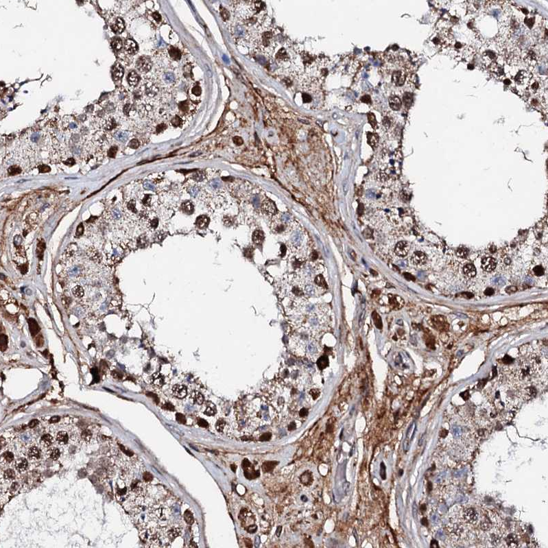Anti-KIF18A Antibody